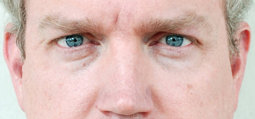 Bill Fick, headshot, (detail) photograph © Bill Fick